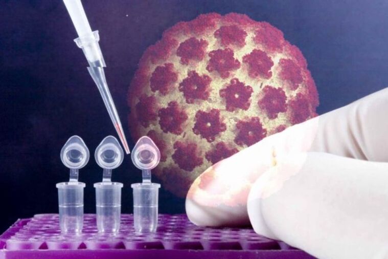 Testes de HPV